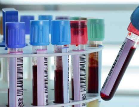 ISO 15189 pour les laboratoires médicaux